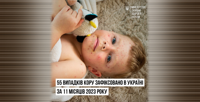 55 випадків кору зафіксовано в Україні за 11 місяців 2023 року